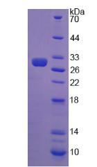 Recombinant Anti-Mullerian Hormone (AMH)