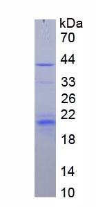 Recombinant Anti-Mullerian Hormone (AMH)