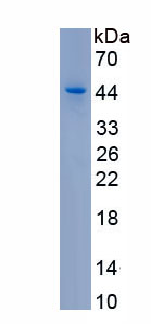 Recombinant Urocortin (UCN)