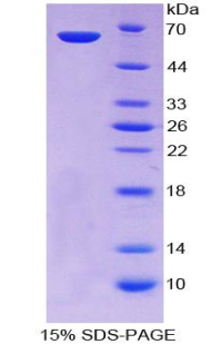 Recombinant Centromere Protein I (CENPI)