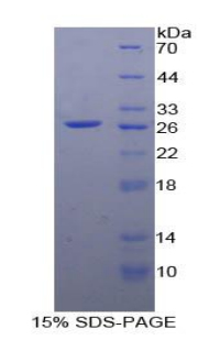 Recombinant Prostaglandin E Receptor 2 (EP2)