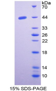 RPA249Hu01.jpg