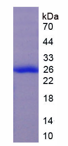 Recombinant Trypsin (TRY)