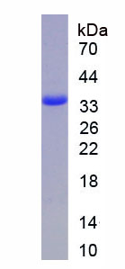 Recombinant Annexin V (ANXA5)