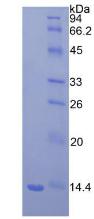 Recombinant Beta-2-Microglobulin (b2M)