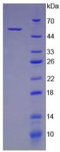 Recombinant Cathepsin K (CTSK)