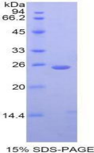 Recombinant Cathepsin K (CTSK)