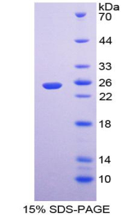 RPA270Hu01.jpg