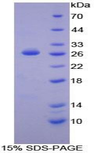 Recombinant Linker For Activation Of T-Cell (LAT)