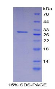 RPA271Hu01.jpg