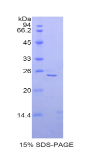 Recombinant Alpha-Fodrin (SPTAN1)