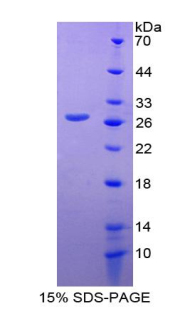 Recombinant Glutamate Dehydrogenase 1 (GLUD1)