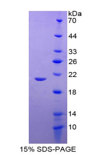 RPA295Hu01.jpg