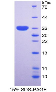 RPA299Hu01.jpg