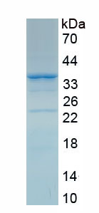 RPA304Hu01.jpg