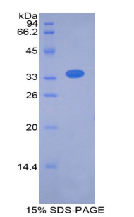 RPA305Hu01.jpg