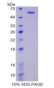 Recombinant Thyroxine Binding Globulin (TBG)