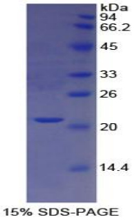 Recombinant Cathepsin L (CTSL)