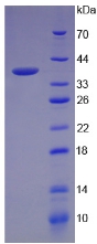 RPA308Hu01.jpg