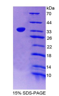 Recombinant Apolipoprotein H (APOH)