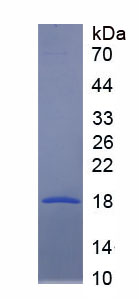 RPA314Hu01.jpg