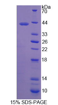 RPA340Hu01.jpg