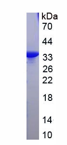 Recombinant Collagen Type I Alpha 1 (COL1a1)