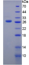 Recombinant Thyroglobulin (TG)