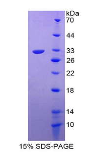 Recombinant Fibroblast Growth Factor 5 (FGF5)