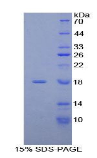 RPA361Hu01.jpg