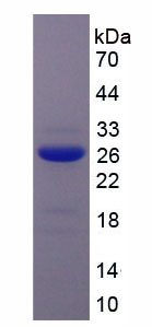 RPA372Hu02.jpg