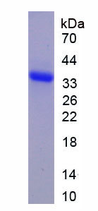 Recombinant Cholecystokinin 4, Tetrapeptide (CCK4)