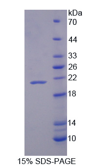 Recombinant Vasoactive Intestinal Peptide (VIP)