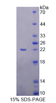 RPA396Hu02.jpg