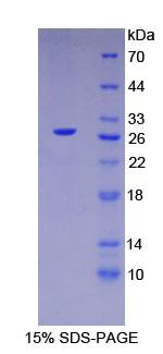 RPA418Hu01.jpg