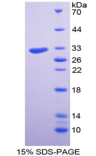 RPA423Hu01.jpg