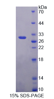 RPA424Hu01.jpg