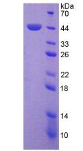 Recombinant Protein Kinase C Delta (PKCd)