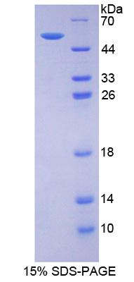 Recombinant Estrogen Receptor Beta (ERb)