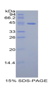 Recombinant Growth Hormone Releasing Hormone (GHRH)