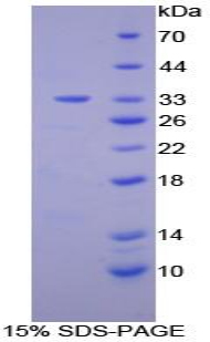 RPA439Hu01.jpg