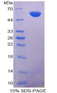 RPA440Hu01.jpg