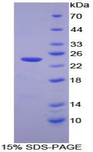 RPA449Hu02.jpg