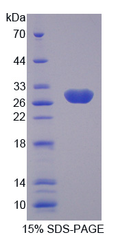 RPA450Hu01.jpg