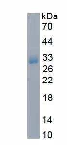 Recombinant Kallikrein 5 (KLK5)