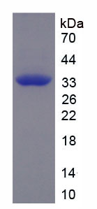 Recombinant Calcitonin (CT)