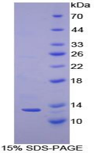 Recombinant Cystatin A (CSTA)