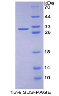 RPA508Hu01.jpg