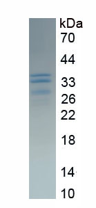 RPA514Hu01.jpg