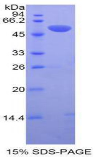 RPA525Hu02.jpg